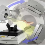 IGRT :画像誘導放射線治療について