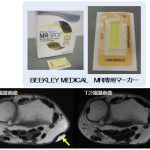 軟部腫瘍のMRI検査