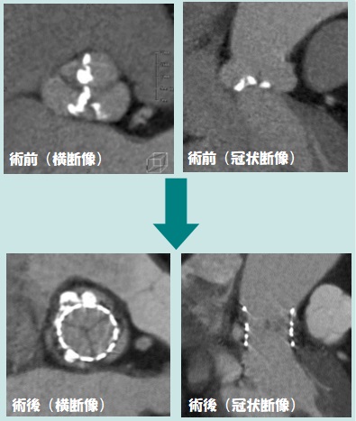 ドキドキしてもハッキリ！クッキリ！ 心電図同期撮影 – Radiology@Home