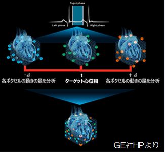 新しい画像補正技術による冠動脈CT撮影の 進化