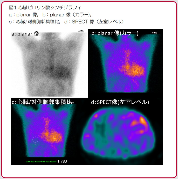 今月の症例（2024.12掲載）