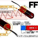 “FFR-Angio”を導入