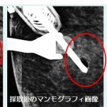 新しい乳腺生検装置が入りました